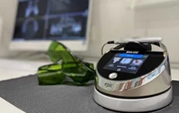 انواع لیزرهای دندانپزشکی و نقش آن‌ها در درمان پری‌ایمپلنتیتیس